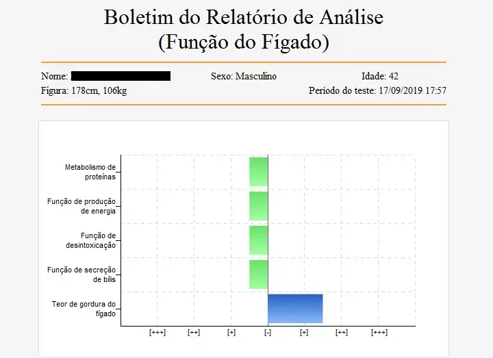 Bianca Enricone - Exame de Biorressonância - Foto Divulgação
